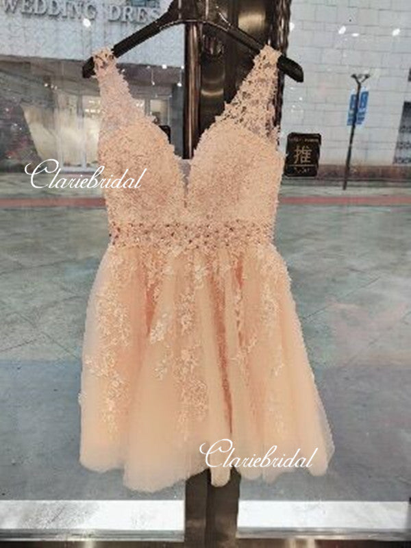 Feedback for V-neck Lace Beaded Dresses